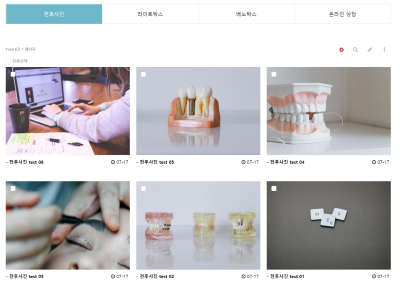 [무료설치] 전후사진 (befor after) 게시판. +@ 모달 팝업 기능