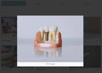 [무료설치] 전후사진 (befor after) 게시판. +@ 모달 팝업 기능